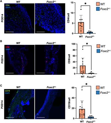 Cancer and lymphatic marker FOXC2 drives wound healing and fibrotic tissue formation